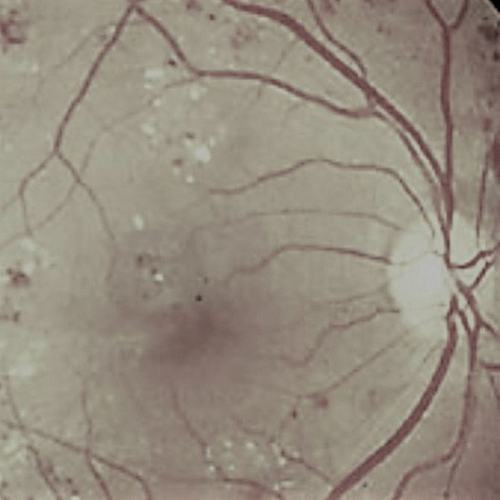 Parasitic Equilibrium : Blood Thoughts